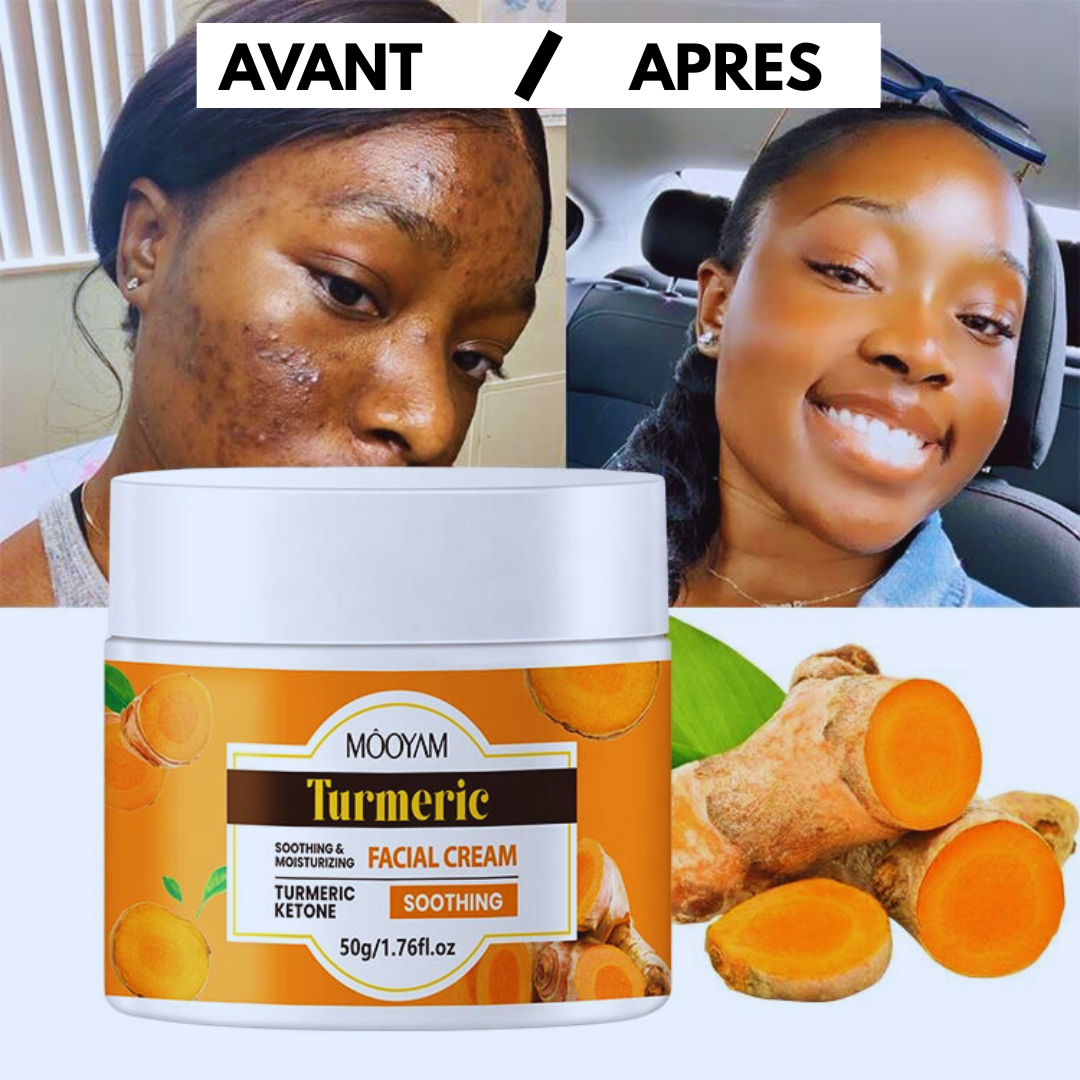 MOOYAM Turmeric Facial Cream – Le secret naturel d’une peau éclatante et sans imperfections