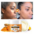 MOOYAM Turmeric Facial Cream – Le secret naturel d’une peau éclatante et sans imperfections