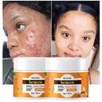 MOOYAM Turmeric Facial Cream – Le secret naturel d’une peau éclatante et sans imperfections